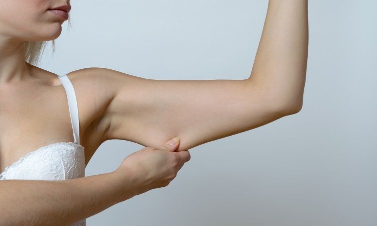 Understanding Arm Lipo and Lift: A Comprehensive Guide