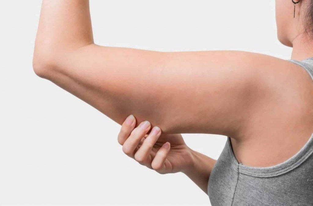 Comprehensive Guide to Under Arm Flab Removal