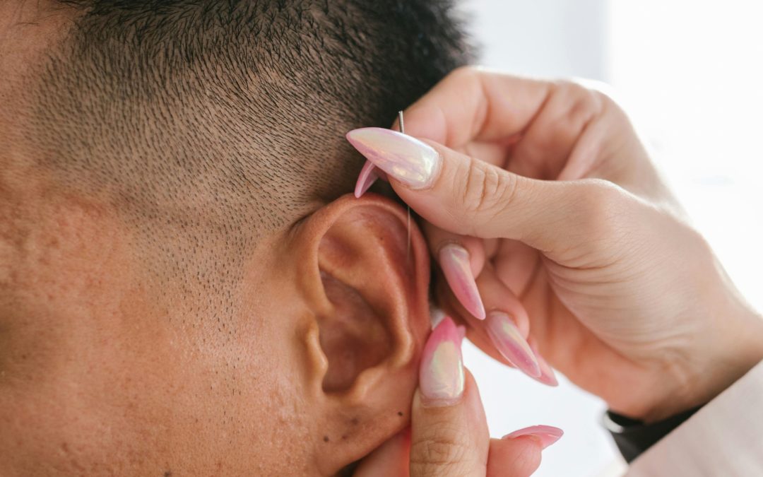 Auriculoterapia para bajar de peso: ¿Cómo funciona?