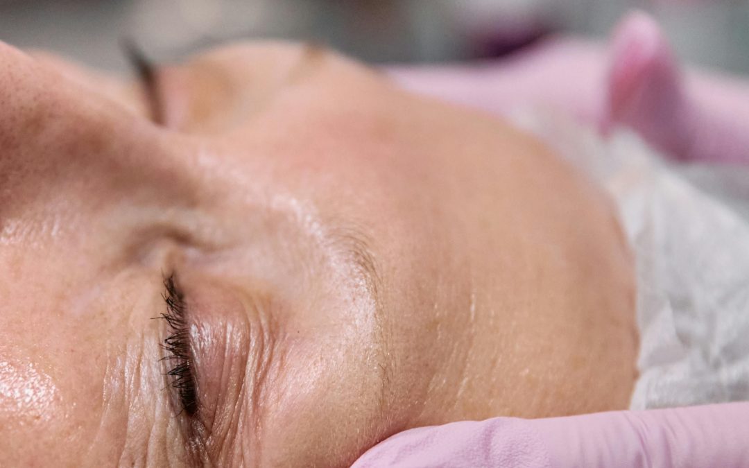 Contraindicaciones de Carboxiterapia: Información Clave