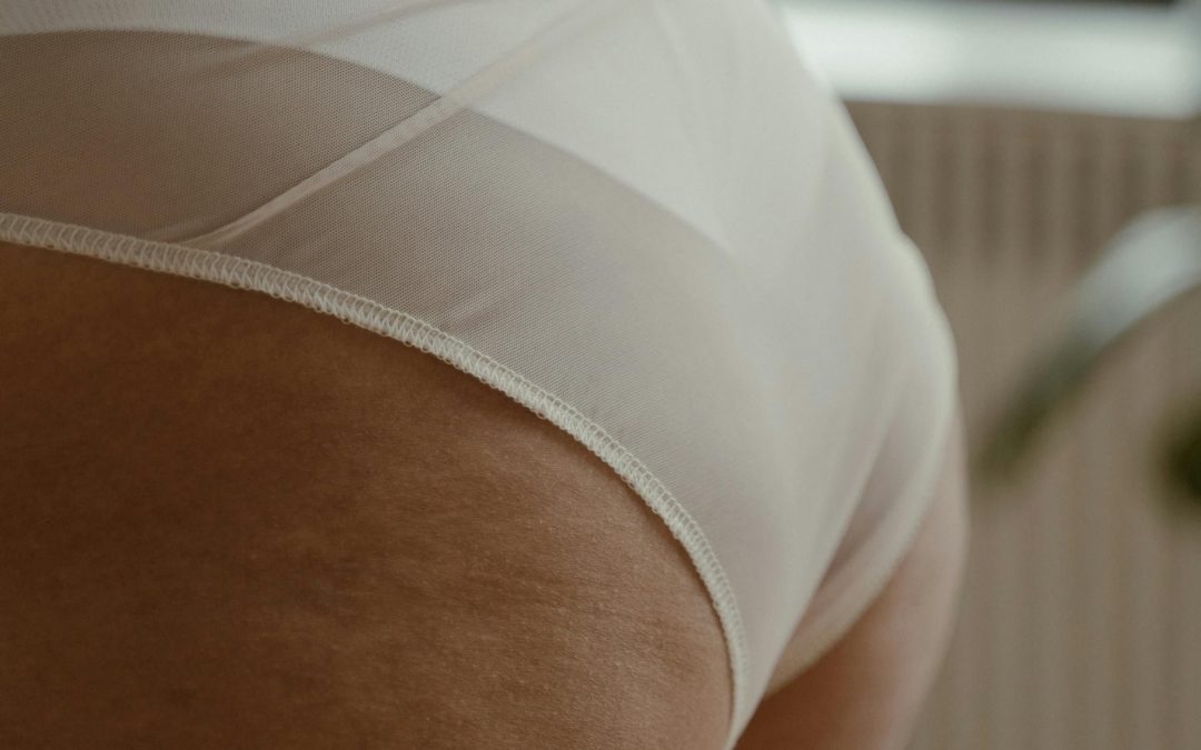 Guía Completa de Celulitis Edematosa Dolorosa