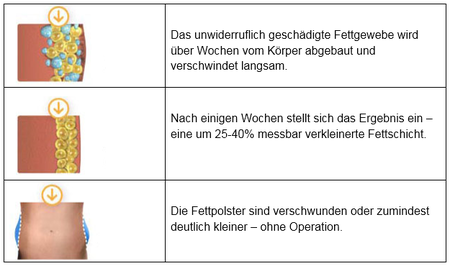 Fettentfernung mittels CoolSculpting® by Zeltiq®: Ablauf der Behandlung, das Fettgewebe wird abgebaut.