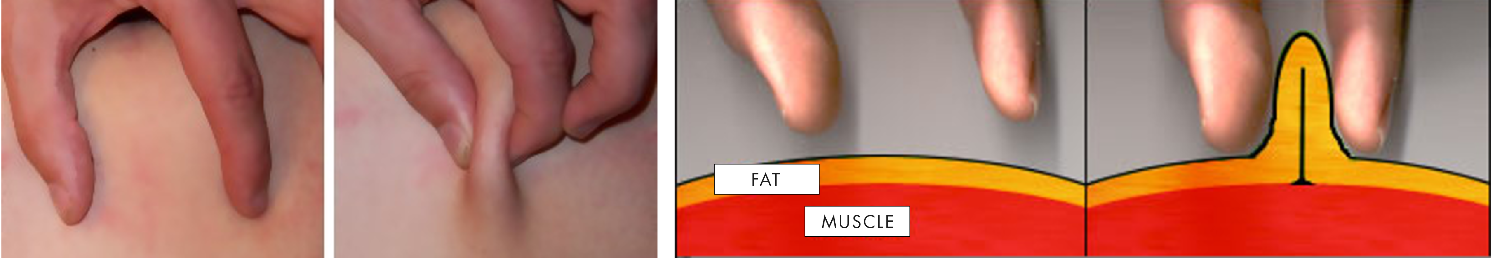 Testing fat or skin