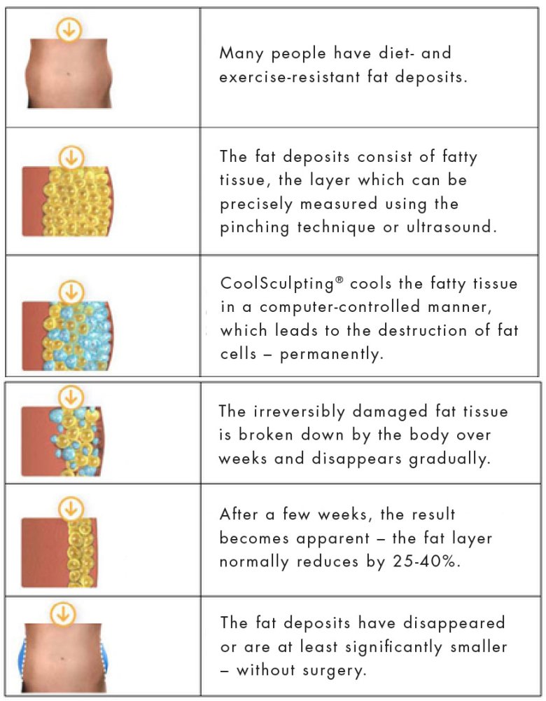 How cryolipolysis works