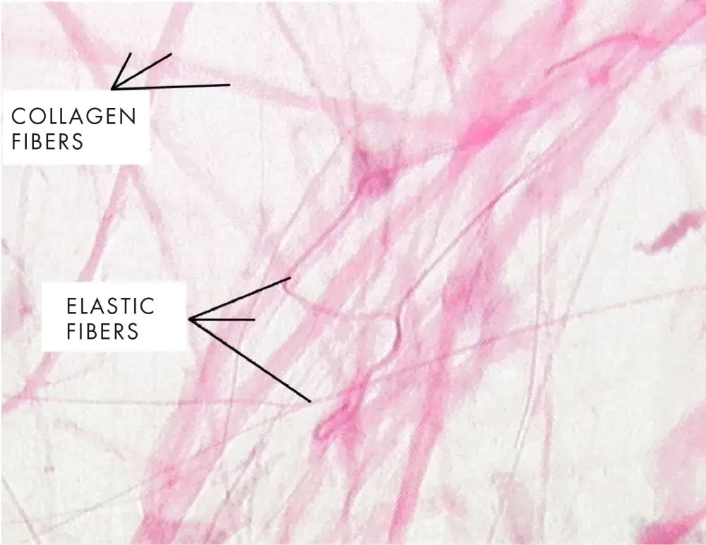 Cellulite Treatment Switzerland collagen production