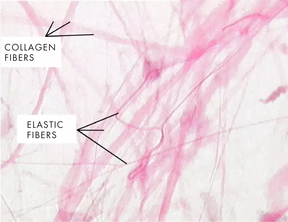 Cellulite Treatment Switzerland collagen production