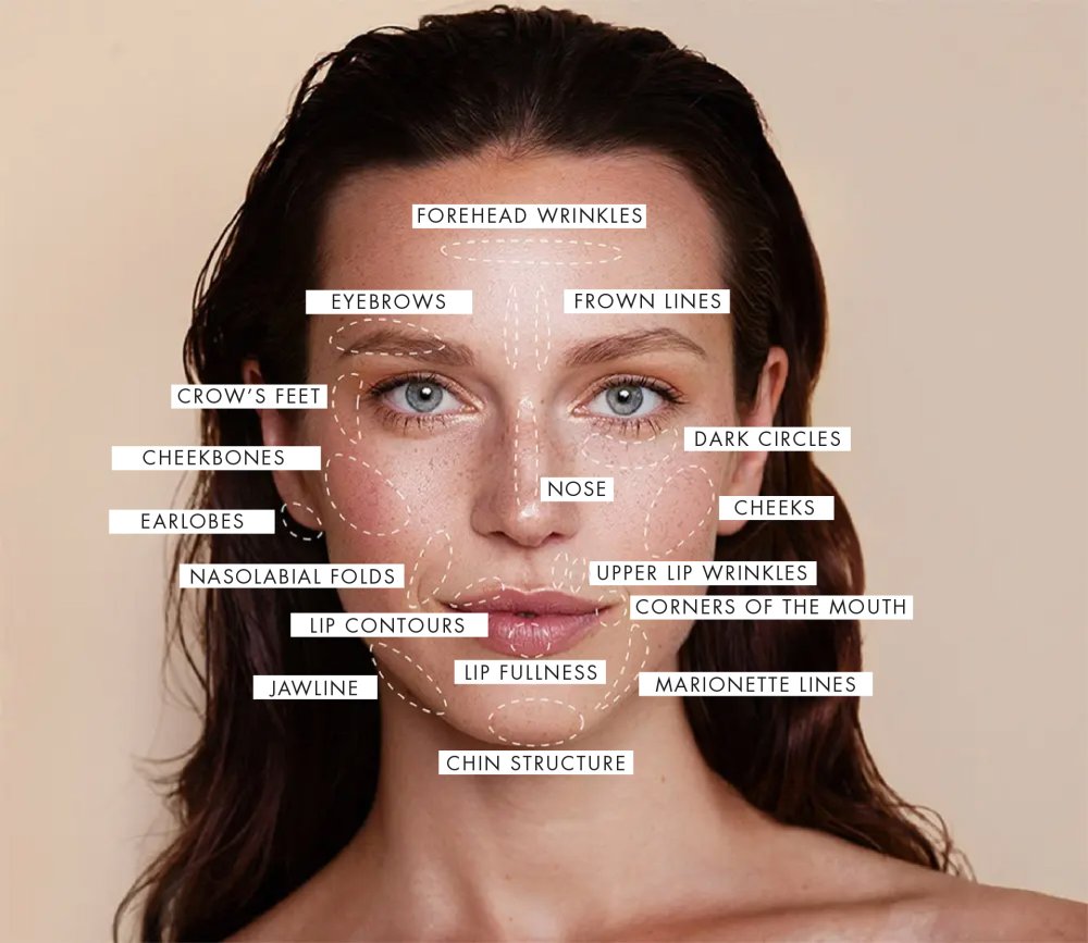 Wrinkles fat grafting face