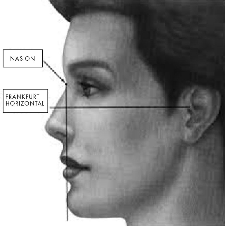 Test perfect chin proportion Lipoclinic