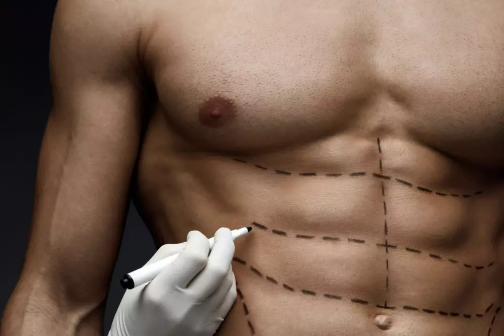 Six-pack