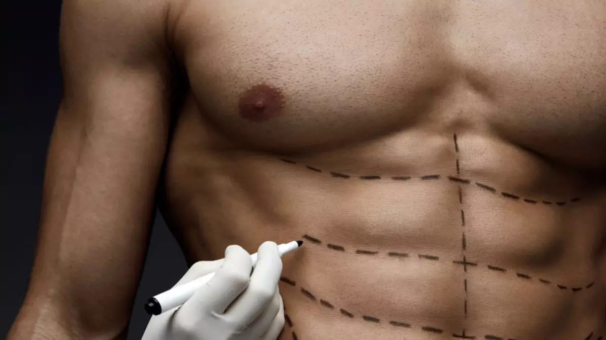 Six-pack